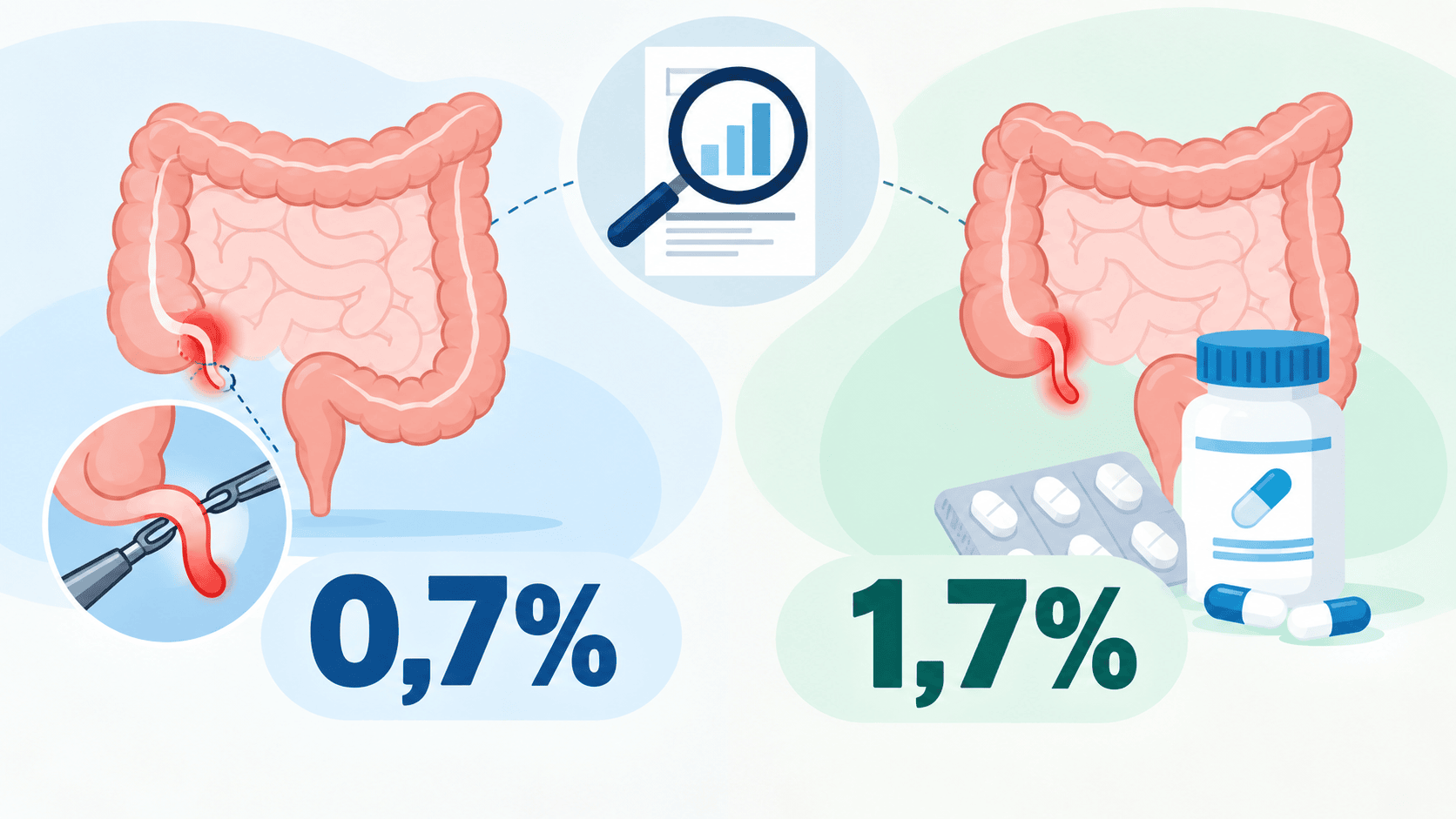Infografica che confronta appendicectomia e terapia antibiotica nell'appendicite acuta con valori dello 0,7% e dell'1,7%